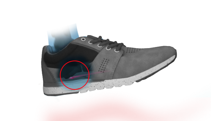 Fersensporn Schuh