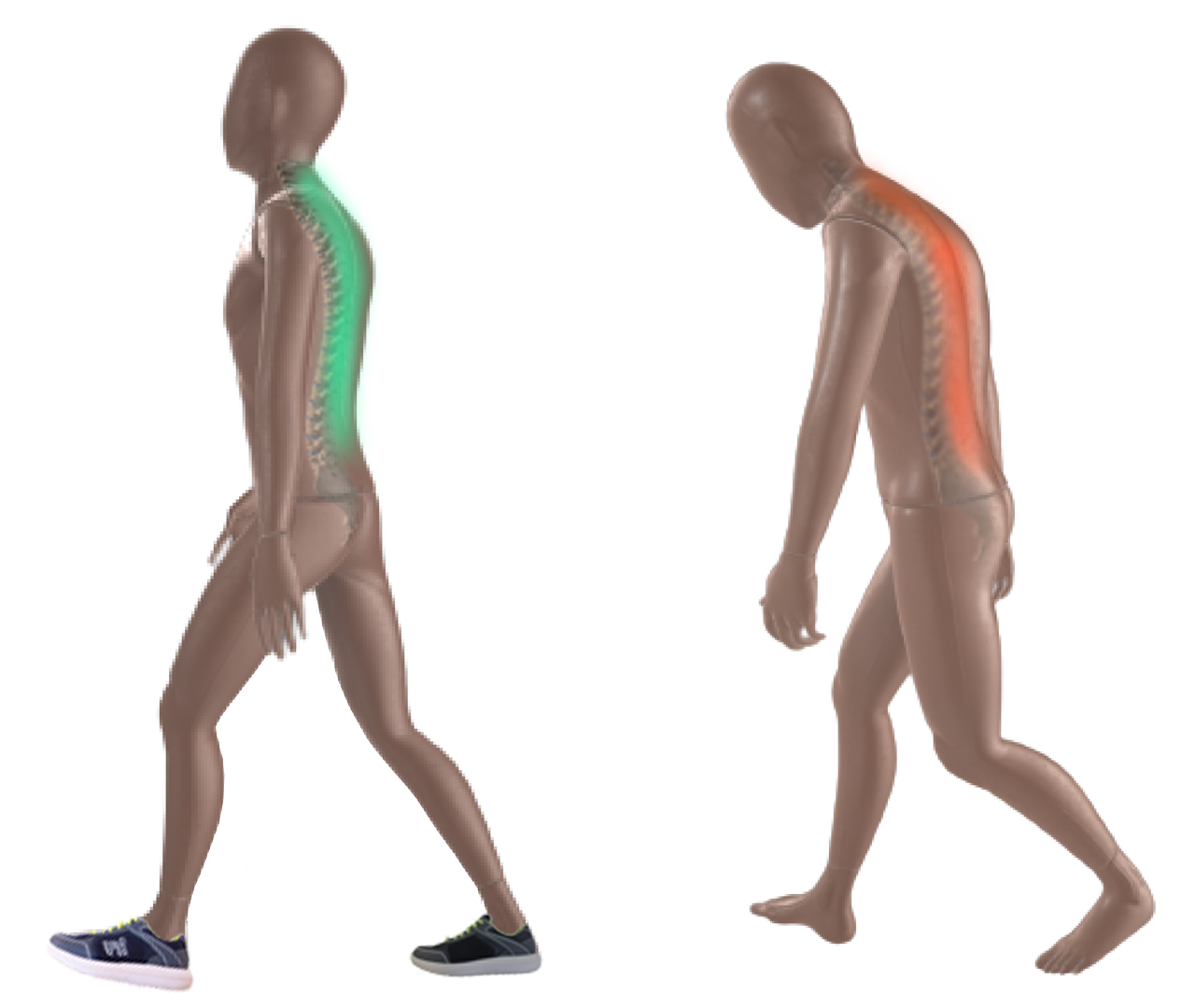 Laufen mit Rückenschmerzen im Vergleich
